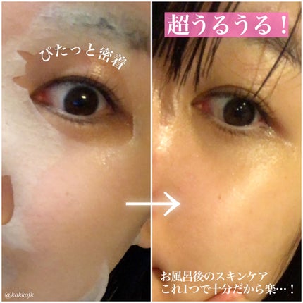 うるうるBOMBマスク/クリアターン/シートマスク・パックを使ったクチコミ(5枚目)