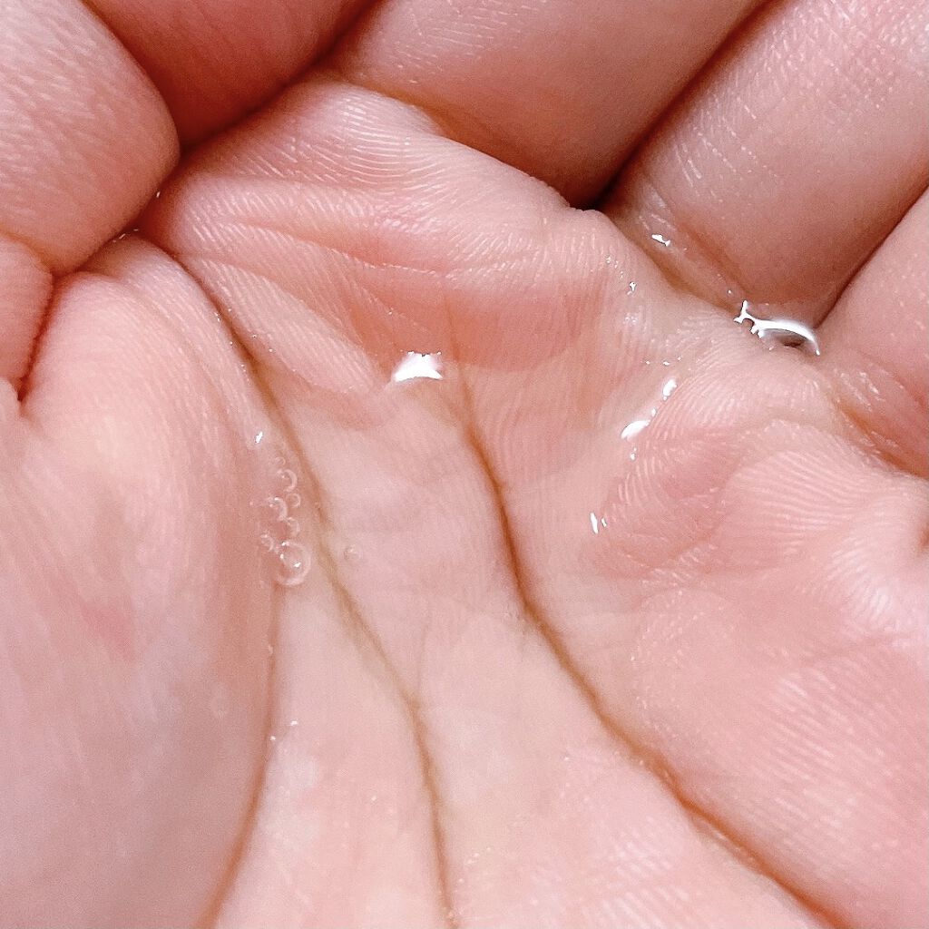 薬用モイストローション/NALC/化粧水を使ったクチコミ（2枚目）