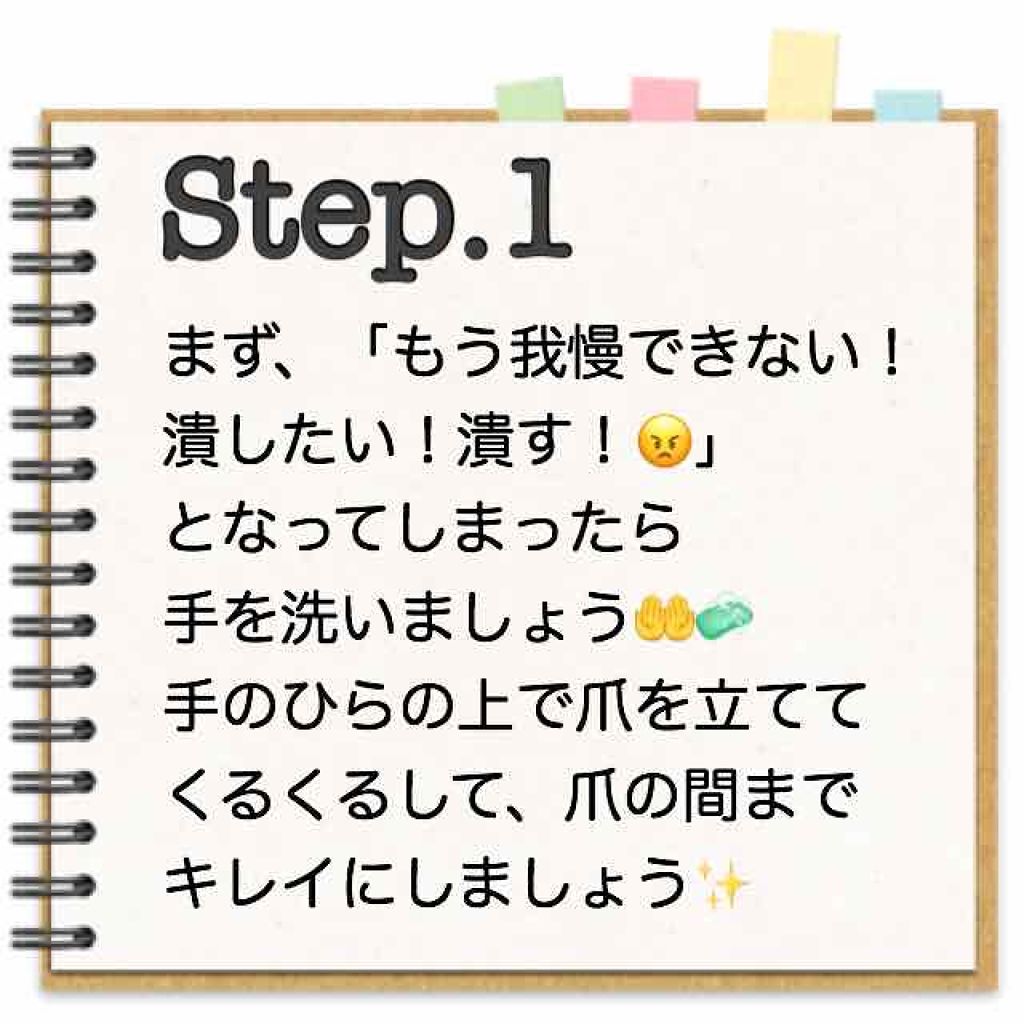 ドルマイシン軟膏 医薬品 ゼリア新薬工業の口コミ どーも ニキビを潰すことが我慢できないゆり By ゆりこ 混合肌 代前半 Lips