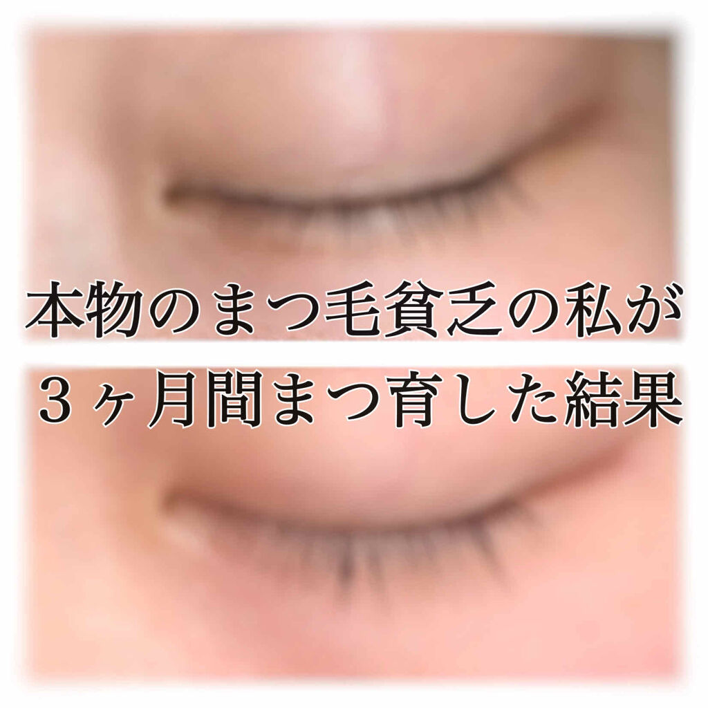 EMAKED（エマーキット）/水橋保寿堂製薬/まつげ美容液を使ったクチコミ（1枚目）