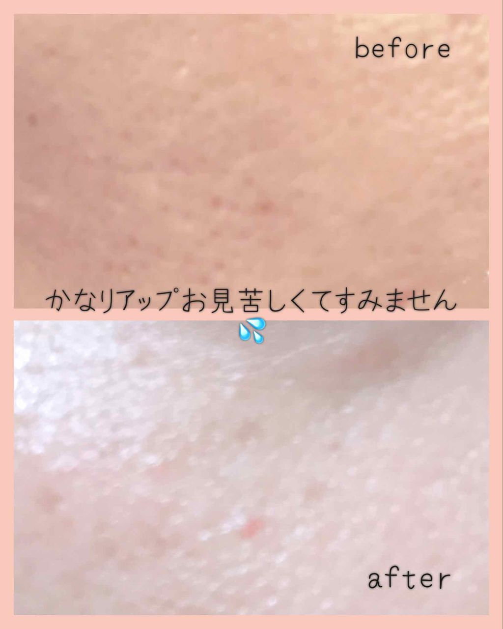 R& SURISURI エマルジョンのクチコミ「『憎き開き毛穴がこれだけで変わる!!?』

⚠️3枚目、肌のアップあります🙏🙏

おはようござ.....」（3枚目）