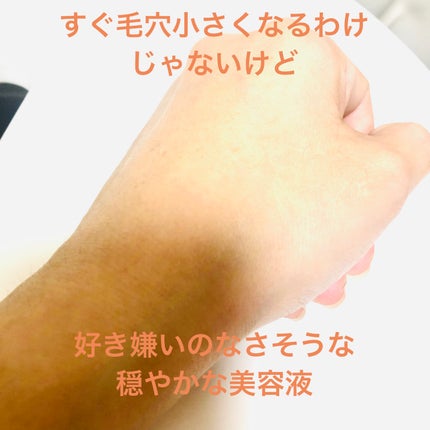 ミシャ ビタシープラス 美容液【日本処方】/MISSHA/美容液を使ったクチコミ(6枚目)