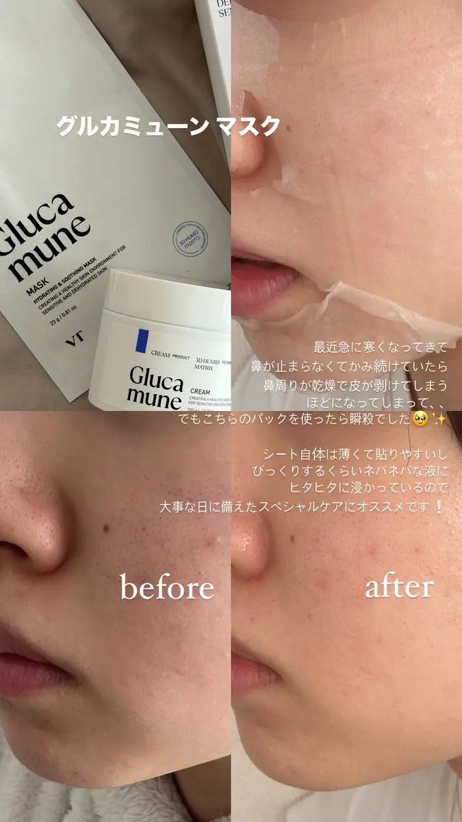 グルカミューンクリーム/VT/フェイスクリームを使ったクチコミ(3枚目)