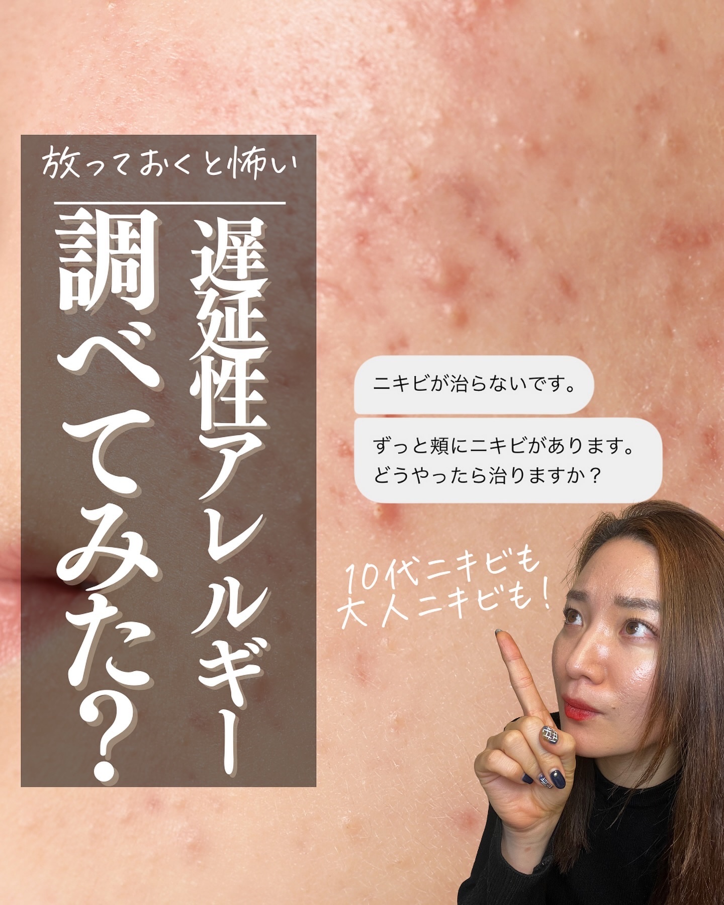 【病院行くほどじゃないけど…っていう不調×ニキビ肌は要チェック】

こんばんは、おゆみです🫶
ニキビ肌属性の方で、生理痛ある、便秘ある、肩こり冷え性ある
など慢性的な不調を抱えている方

○食べるの好きですか？
○1人ご飯で麺選びがちじゃ