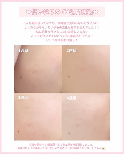 ビタペアCデイリーシートマスク/ネイチャーリパブリック/シートマスク・パックを使ったクチコミ(5枚目)