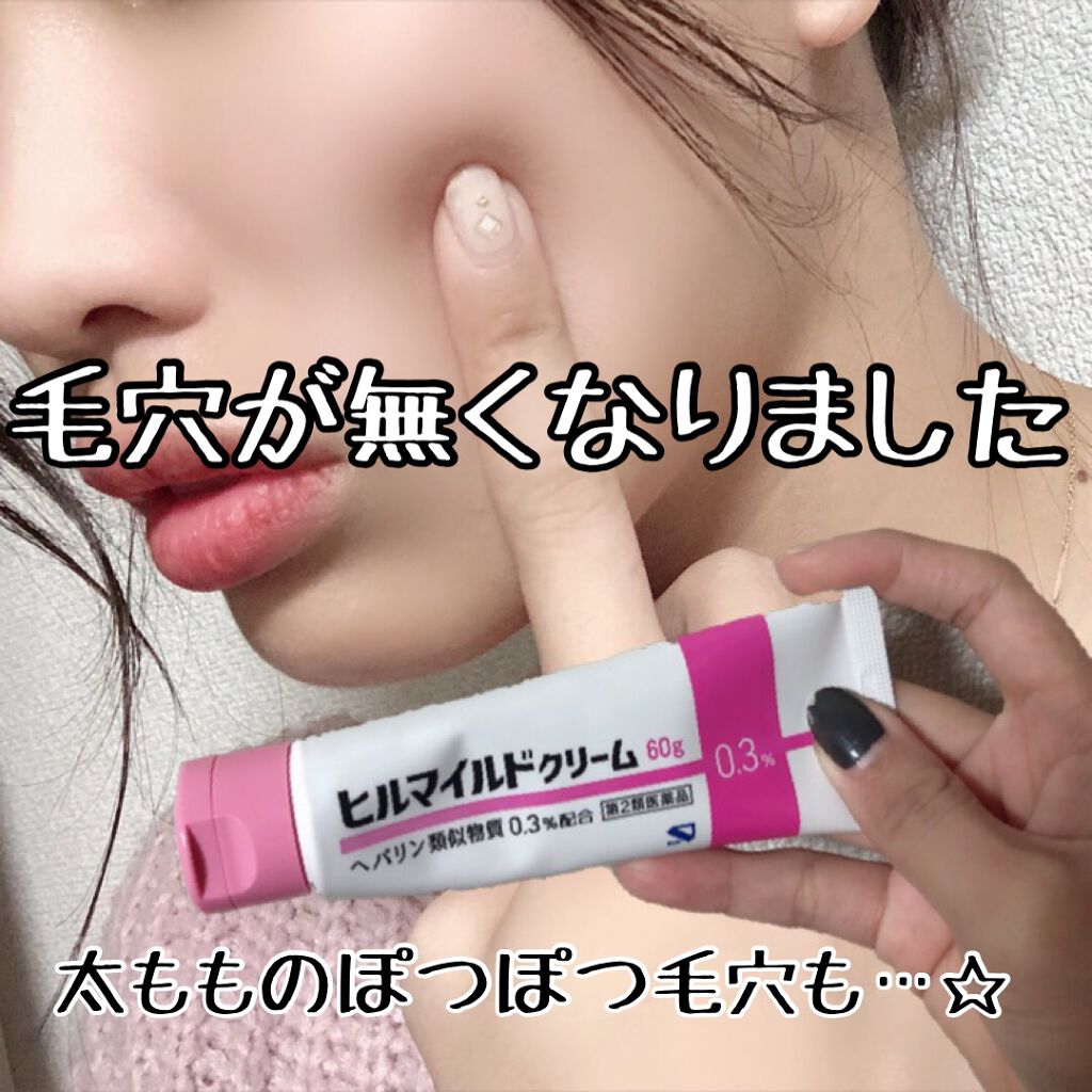 ヒルマイルドクリーム(医薬品)/健栄製薬/その他を使ったクチコミ(1枚目)
