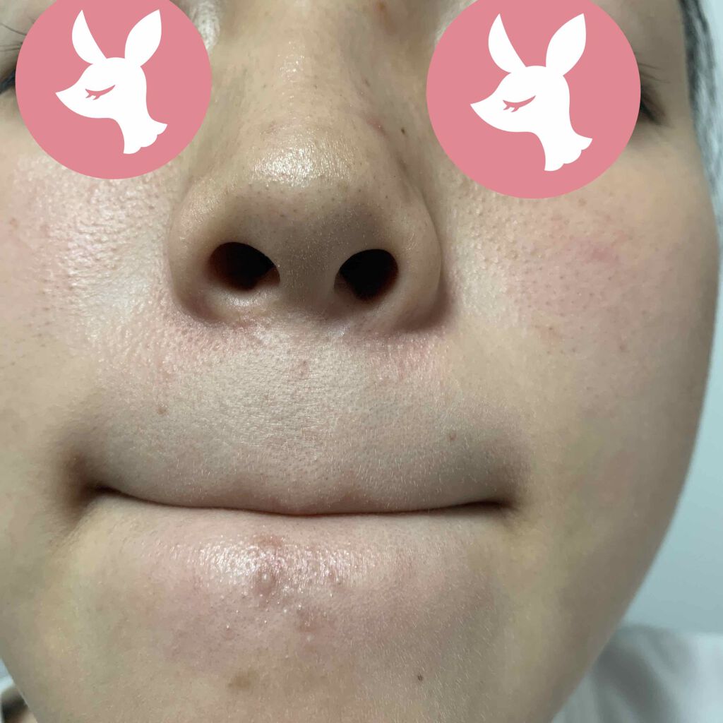 を使ったクチコミ（1枚目）