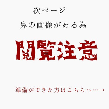 薬用毛穴すっきり粒つぶ洗顔/メンソレータム アクネス/洗顔フォームを使ったクチコミ（2枚目）