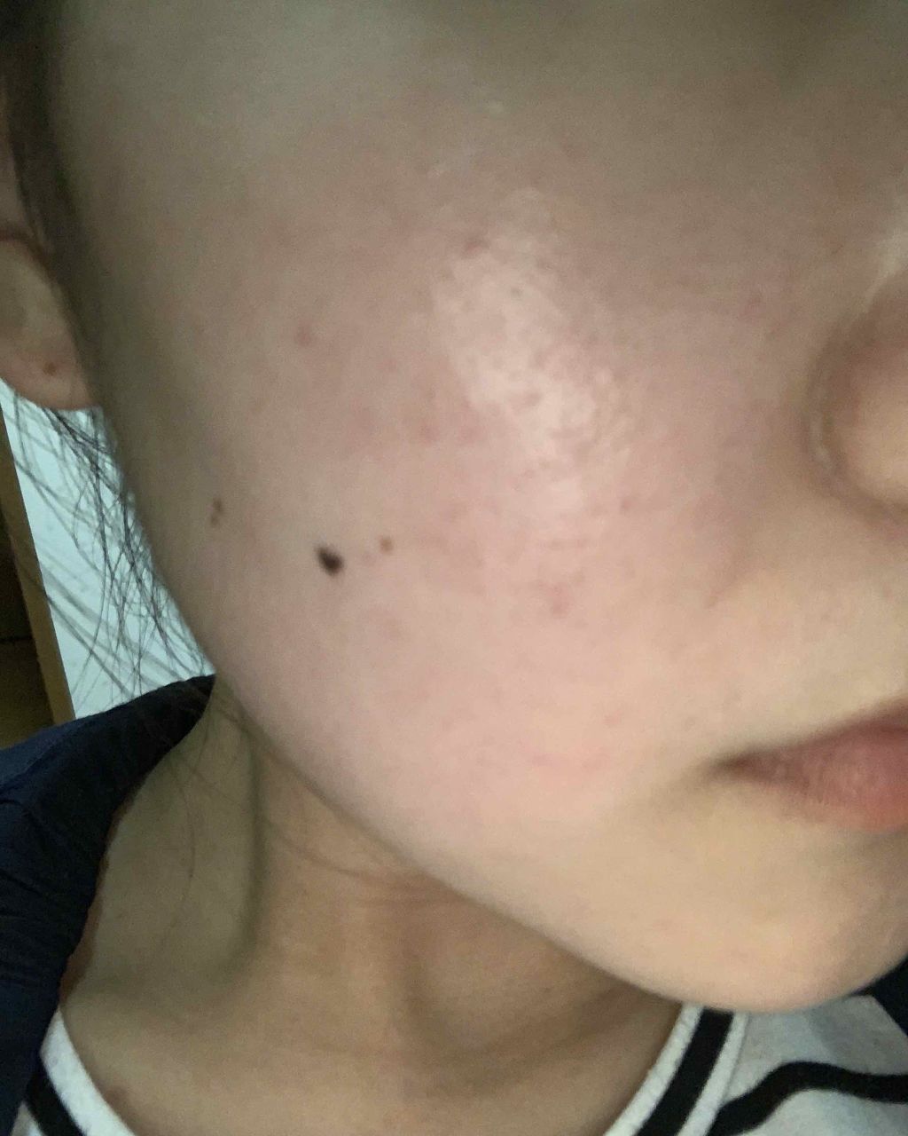 薬用しみ対策 美白化粧水/メラノCC/化粧水を使ったクチコミ（3枚目）