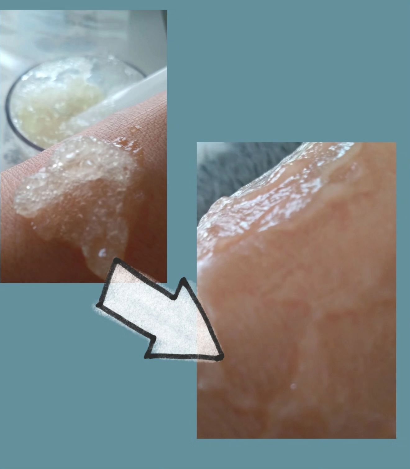 炭酸ジェルパック/NANO ACQUA/洗い流すパック・マスクを使ったクチコミ（3枚目）