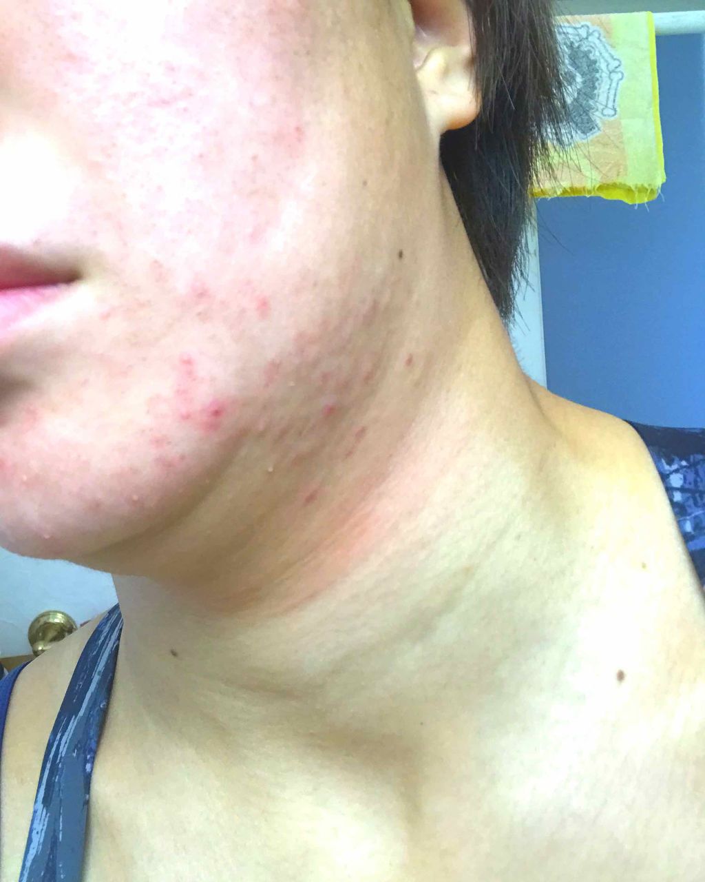 モイストケアローション 2/フリープラス/化粧水を使ったクチコミ(2枚目)