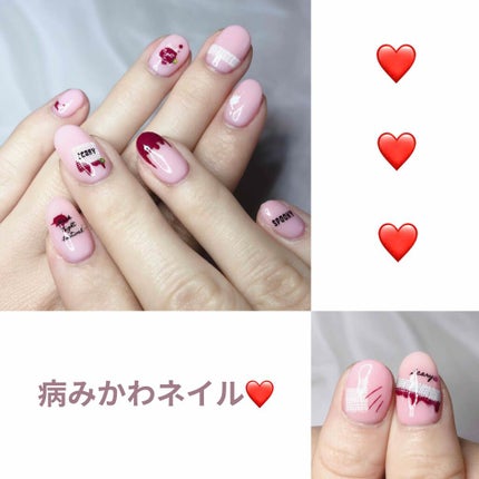 ネイルクレンザー/HOMEI/除光液を使ったクチコミ(1枚目)