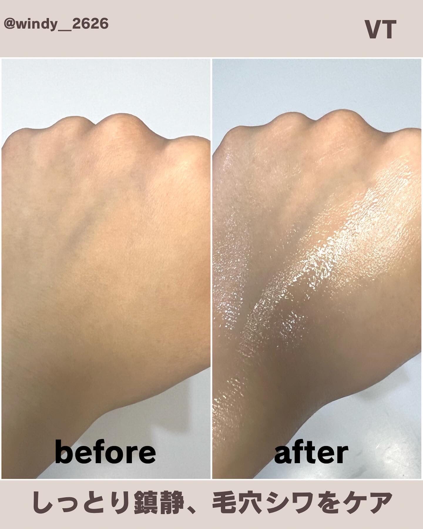 シカレチA セブンデイズマスク/VT/シートマスク・パックを使ったクチコミ（3枚目）