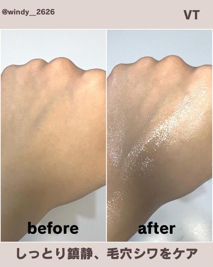 CICA クリーム/VT/フェイスクリームを使ったクチコミ(3枚目)