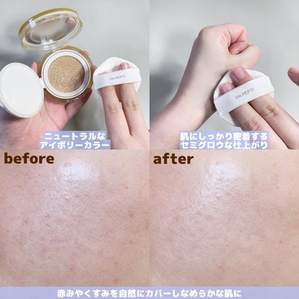 ペプチド ボリューム リフティングプロエッセンス/DR.PEPTI/美容液を使ったクチコミ(7枚目)