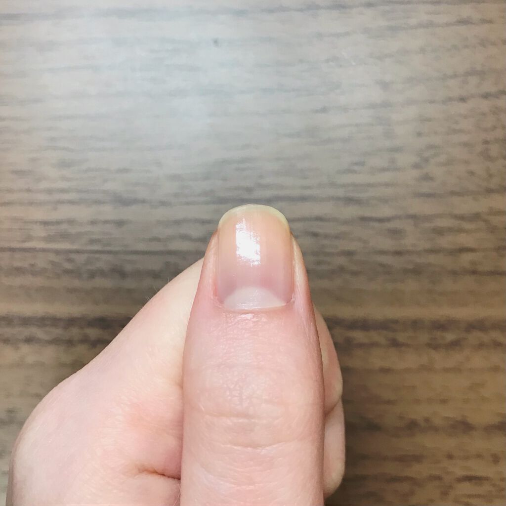 ウィンマックス ネイルケアシリーズ ベースコート/DAISO/ネイルベースコートを使ったクチコミ(4枚目)