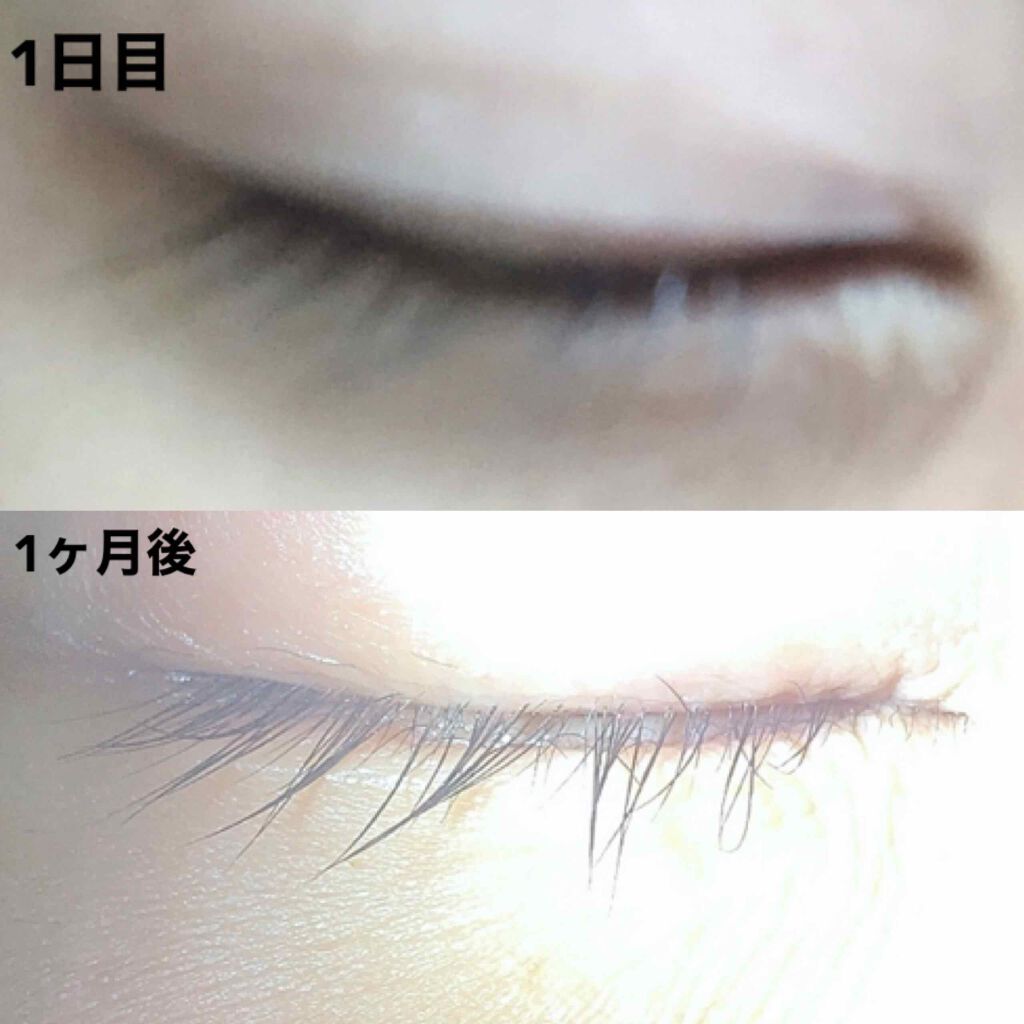 ローヤルゼリー配合 栄養ローション/DAISO/美容液を使ったクチコミ(3枚目)