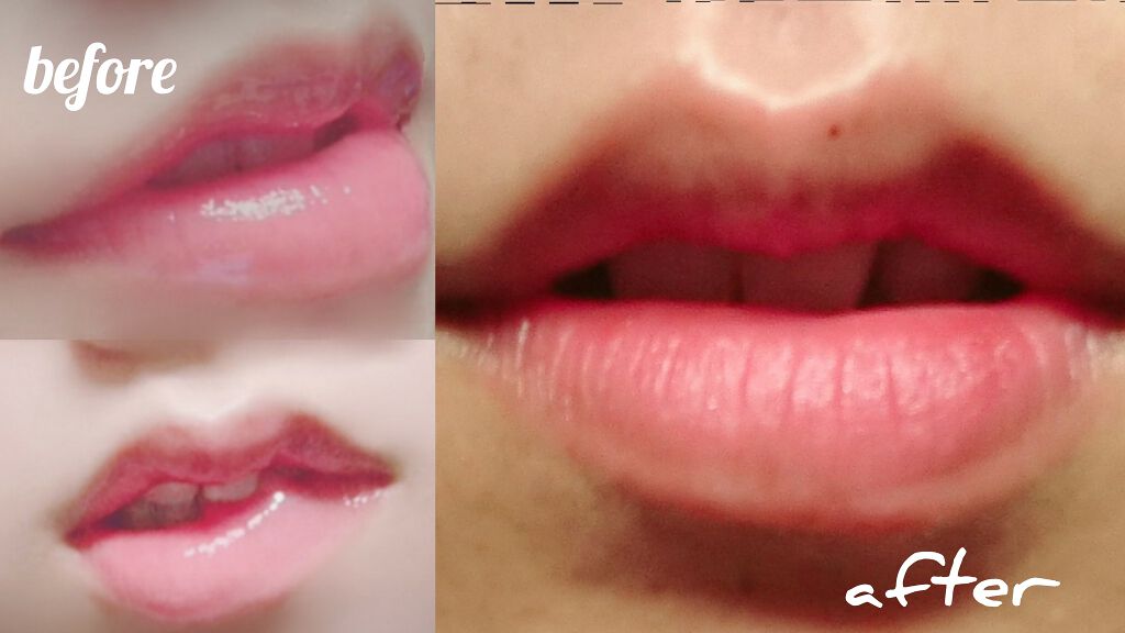 アスリートプロ UVリップクリーム/BRISA MARINA(ブリサマリーナ)/リップケアを使ったクチコミ(2枚目)