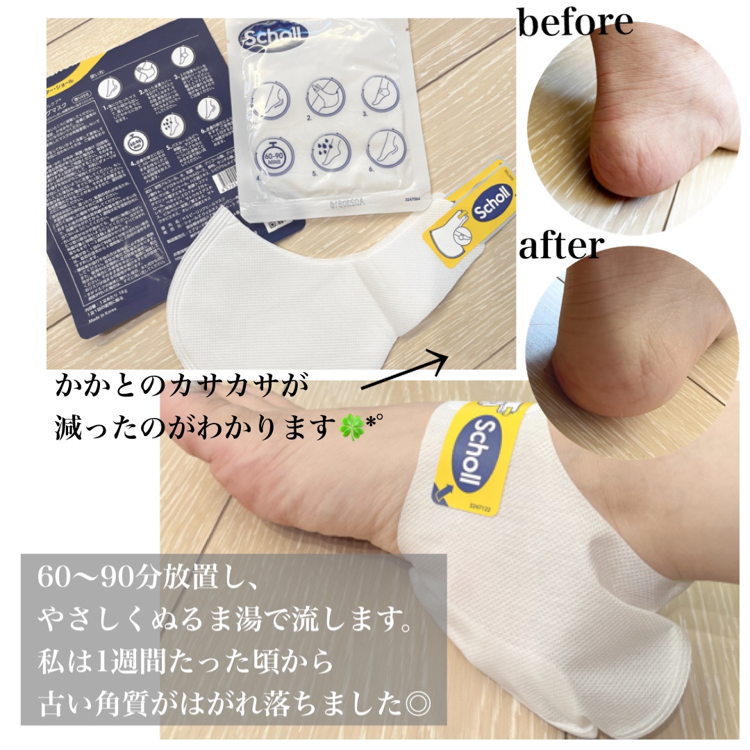 かかとピーリングマスク/ドクター・ショール/レッグ・フットケアを使ったクチコミ（2枚目）