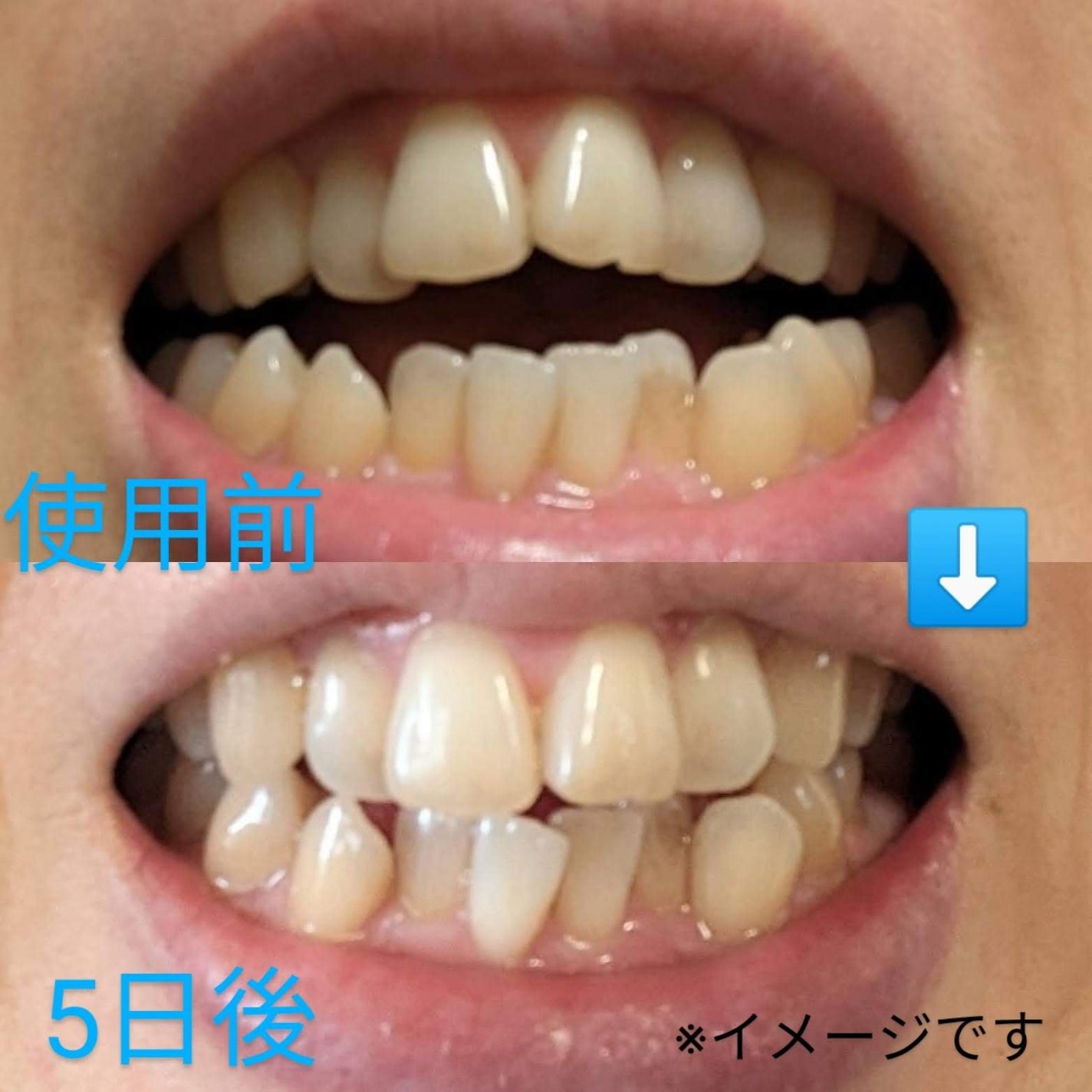 ホワイトパープル歯みがき ピーチフローラルミントの香り/EUTHYMOL/歯磨き粉を使ったクチコミ(4枚目)