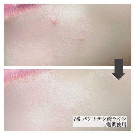 1番 塗るパントテン酸スージングクリーム/numbuzin/フェイスクリームを使ったクチコミ(5枚目)