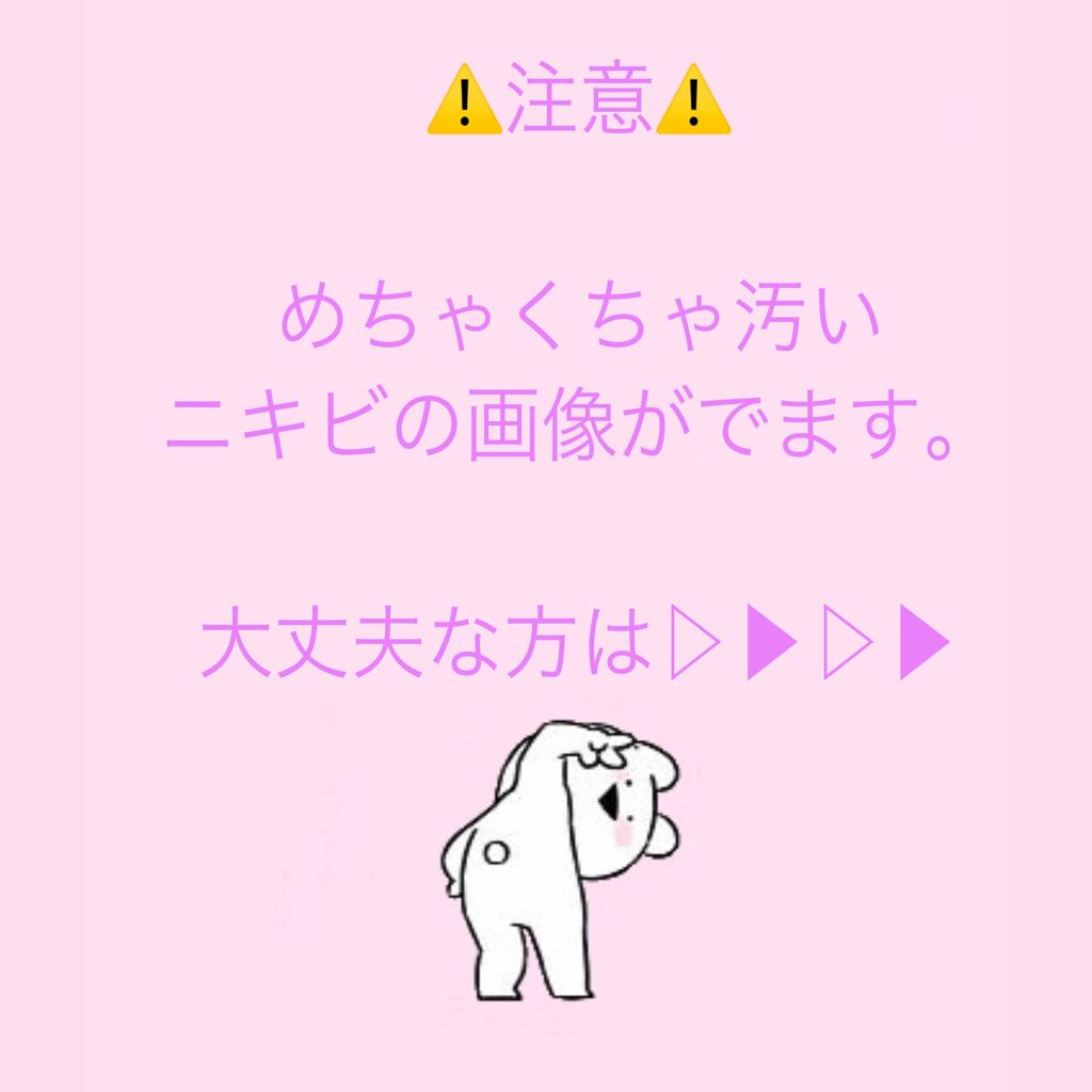 スキンピールバー AHA/サンソリット/洗顔石鹸を使ったクチコミ（2枚目）