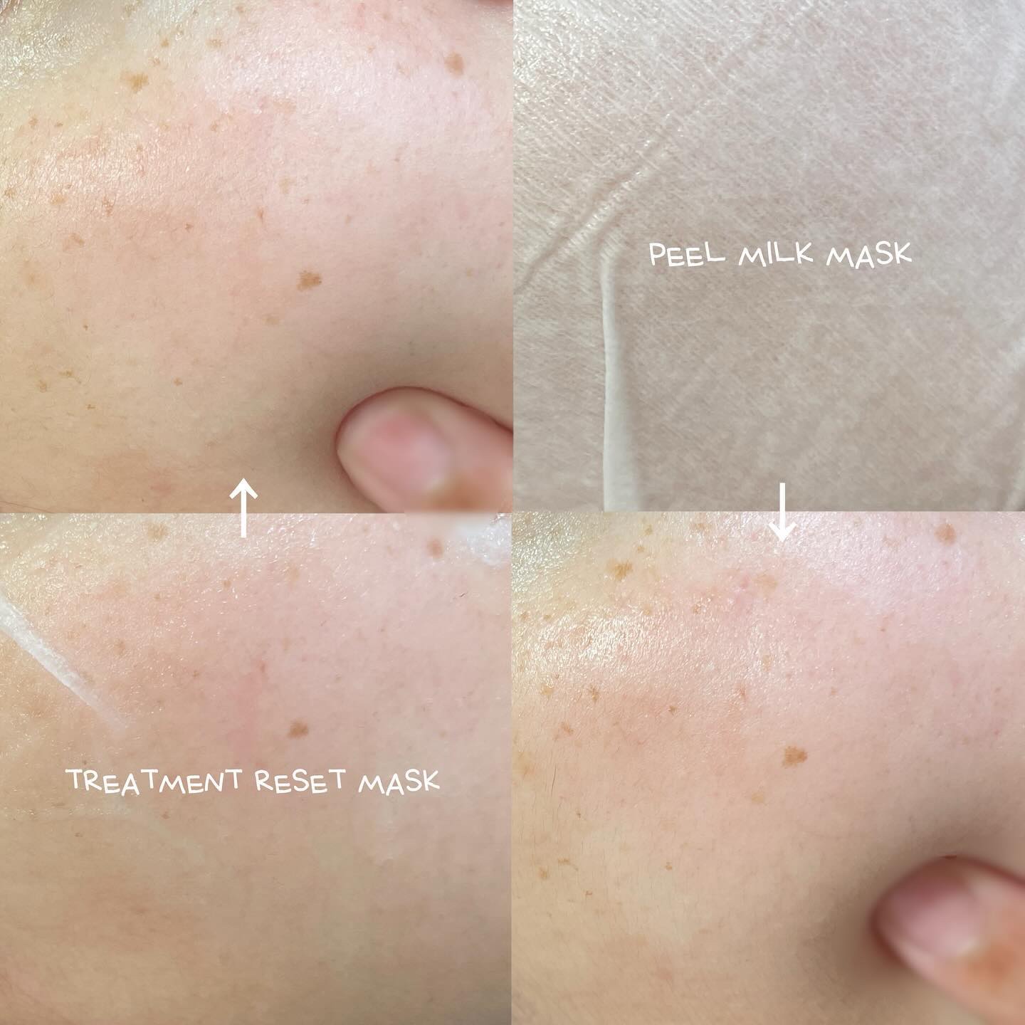 ピールミルクマスク/ALFACE+/シートマスク・パックを使ったクチコミ（2枚目）