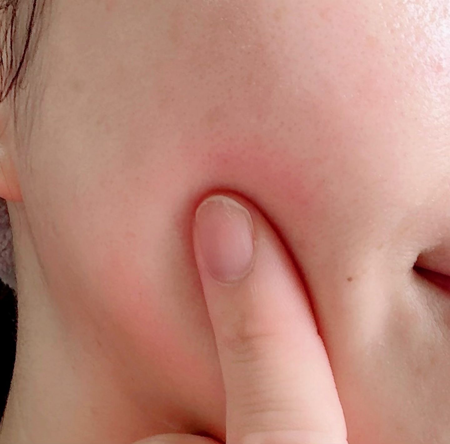 Cリンクエッセンス/ビューティフルスキン/美容液を使ったクチコミ（3枚目）