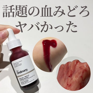 The Ordinary AHA 30% + BHA 2% Peeling Solutionのクチコミ「.
(他の毛穴商品はここから→@keana_nara)
.
見た目グロすぎる😱「血みどろピーリ.....」（1枚目）