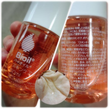 バイオイル/バイオイル/フェイスオイルを使ったクチコミ(1枚目)