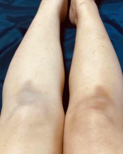 薬用ホワイトコンク ホワイトニングCC CII/ホワイトコンク/ボディクリームを使ったクチコミ(6枚目)