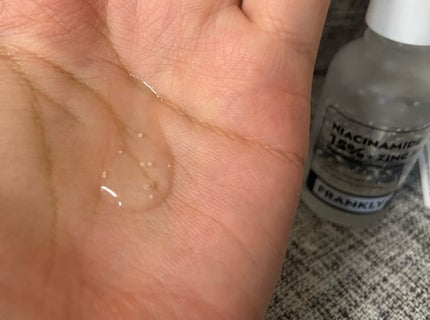 ナイアシンジンクビーズセラム/Frankly/美容液を使ったクチコミ(4枚目)