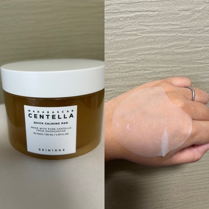 センテラ クイックカーミングパッド/SKIN1004/トナーパッドを使ったクチコミ(1枚目)