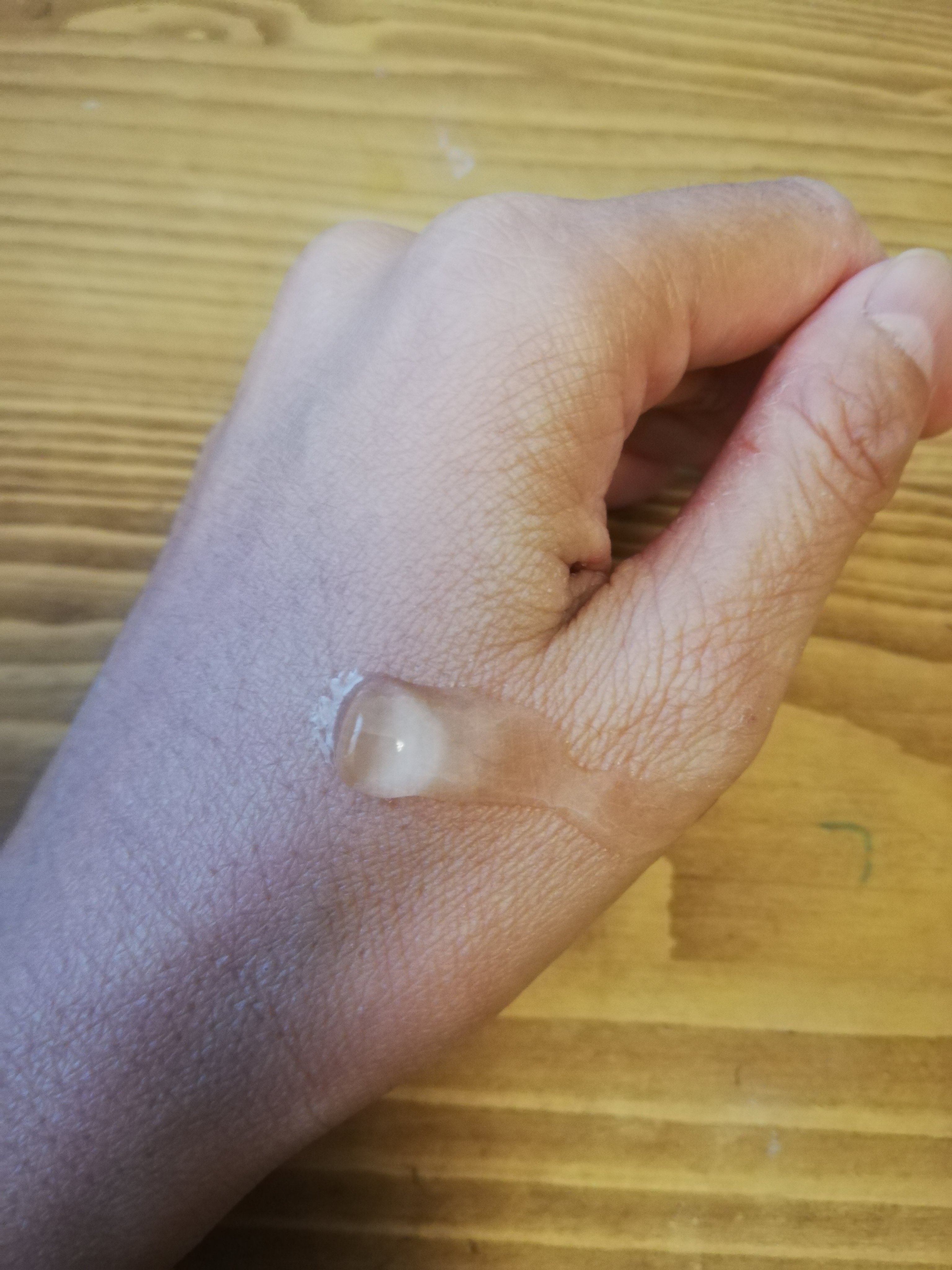 ホットスクラブクレンジングジェル/skinvill/クレンジングジェルを使ったクチコミ（3枚目）