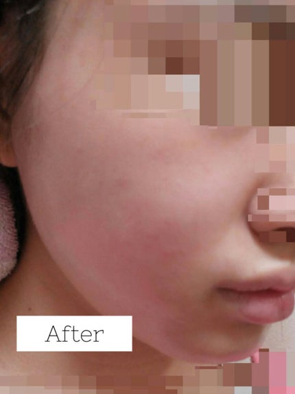 ももぷり フレッシュピールオフパック/ももぷり/ピーリングを使ったクチコミ(3枚目)