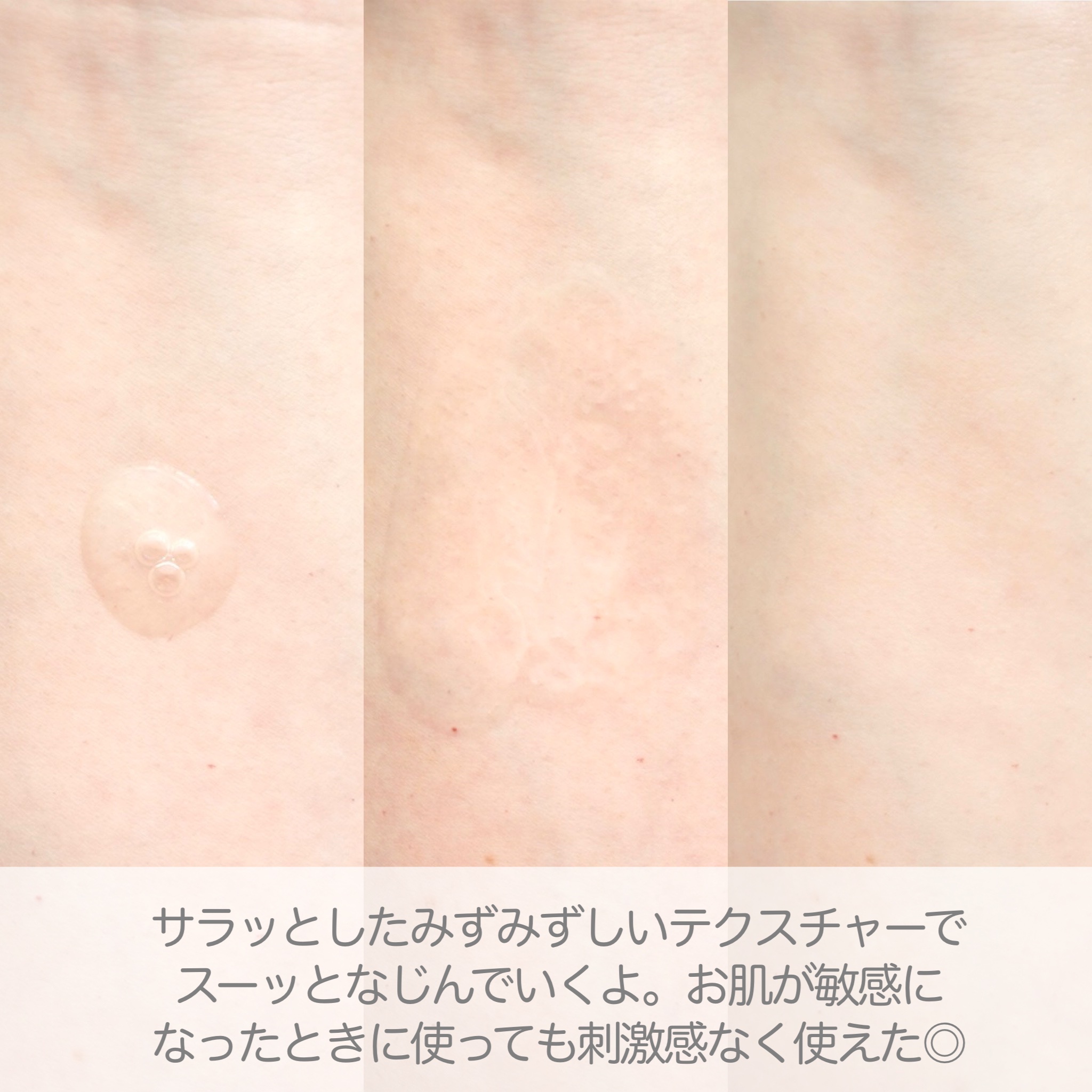 ノスカナイン トラブルクリーム/FATION/フェイスクリームを使ったクチコミ（3枚目）