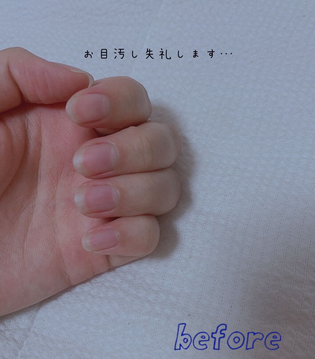 エテュセ クイックケアコート/ettusais/ネイルオイル・トリートメントを使ったクチコミ（2枚目）