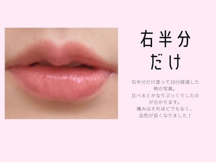 リップエッセンス/無印良品/リップケアを使ったクチコミ(4枚目)