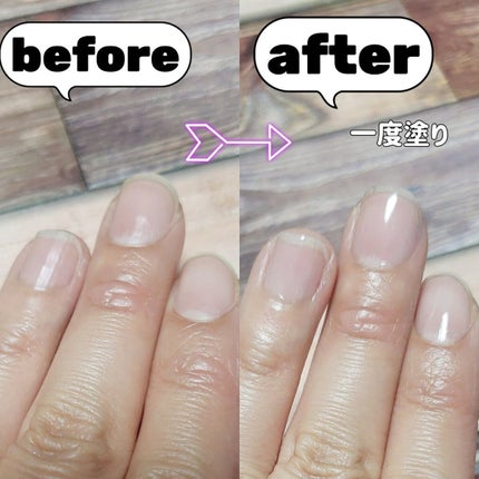 プレビュート クリア/プレビュート/オールインワンネイルを使ったクチコミ(3枚目)