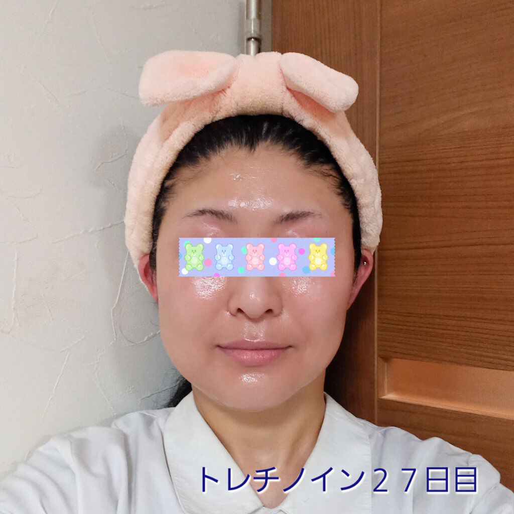 リンクルシートマスク Ｎ/なめらか本舗/シートマスク・パックを使ったクチコミ（1枚目）