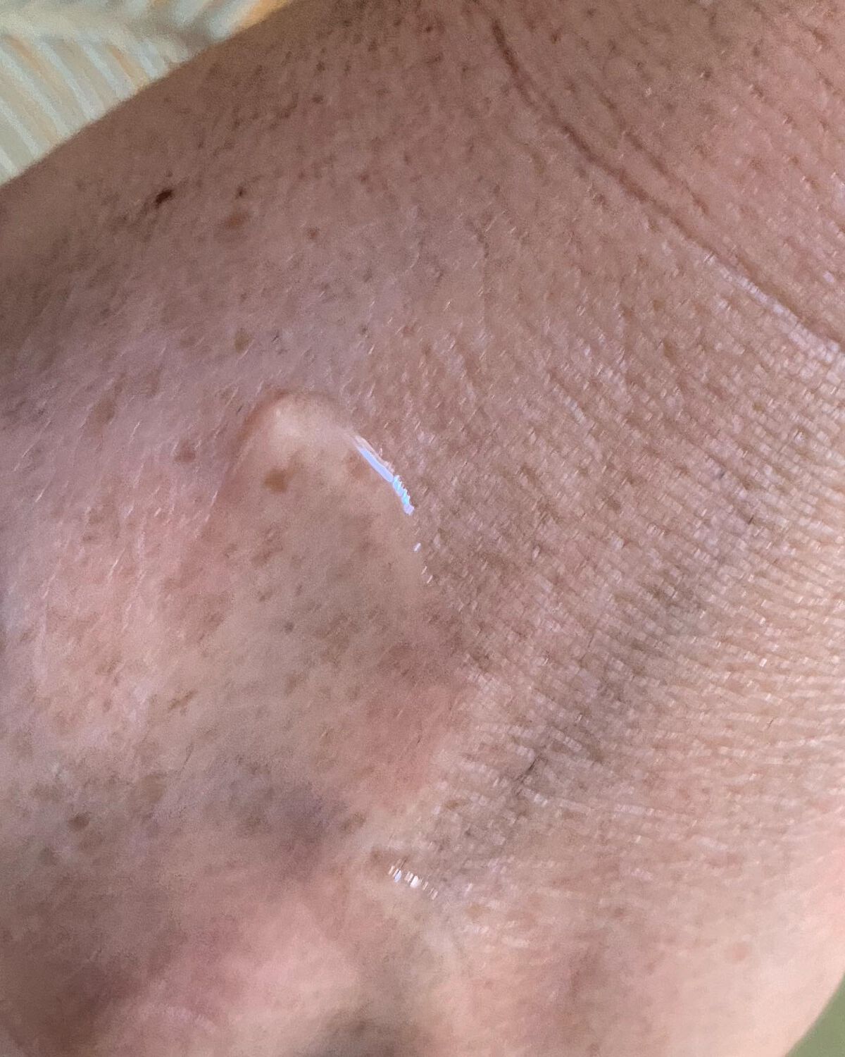 イドラクラリティ 薬用 トリートメント エッセンス ウォーター/DECORTÉ/化粧水を使ったクチコミ(4枚目)