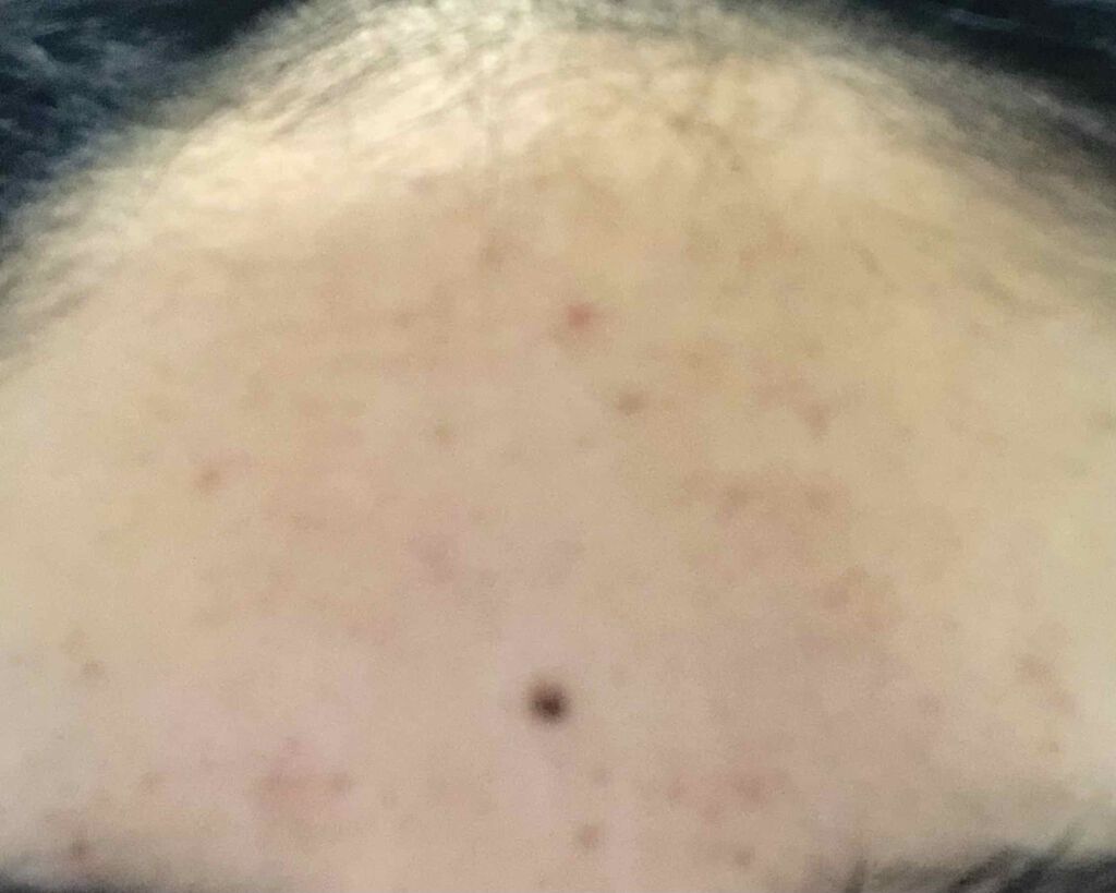 リアルキャロットブレミッシュセラム/APRILSKIN/美容液を使ったクチコミ（2枚目）