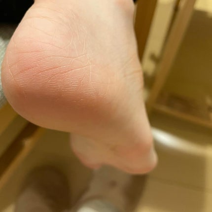 ゴウンバル クリーム/3WB/レッグ・フットケアを使ったクチコミ(4枚目)