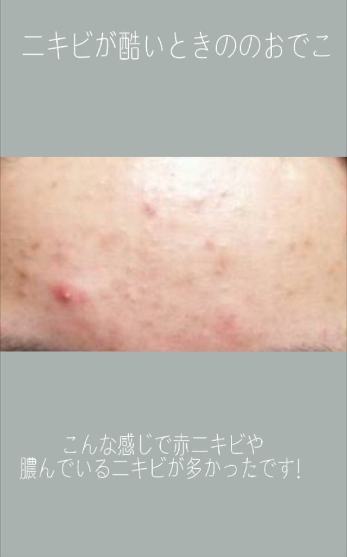 ハトムギ保湿ジェル(ナチュリエ スキンコンディショニングジェル)/ナチュリエ/美容液を使ったクチコミ（2枚目）