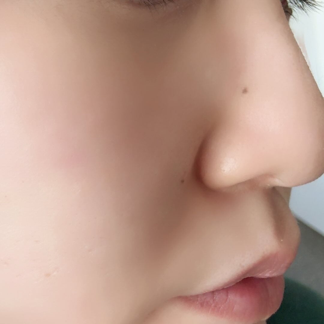 薬用化粧水/スキンライフ/化粧水を使ったクチコミ(9枚目)