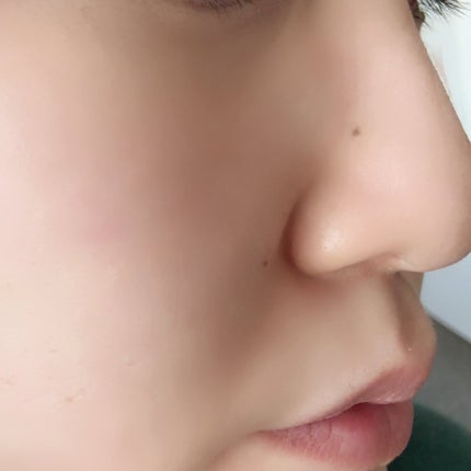 薬用化粧水/スキンライフ/化粧水を使ったクチコミ(9枚目)