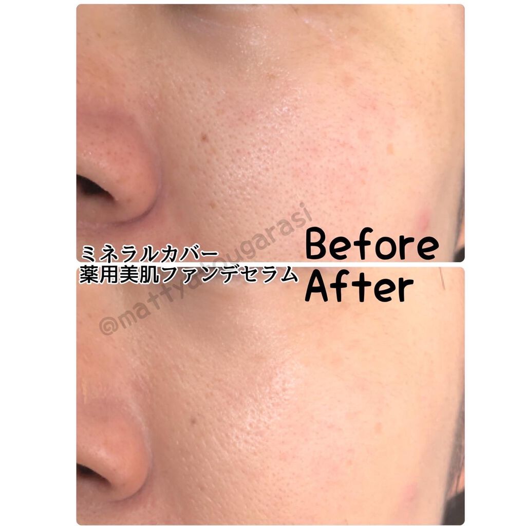 ミネラルカバー薬用美白ファンデセラム/ミリオナ化粧品/美容液を使ったクチコミ(3枚目)