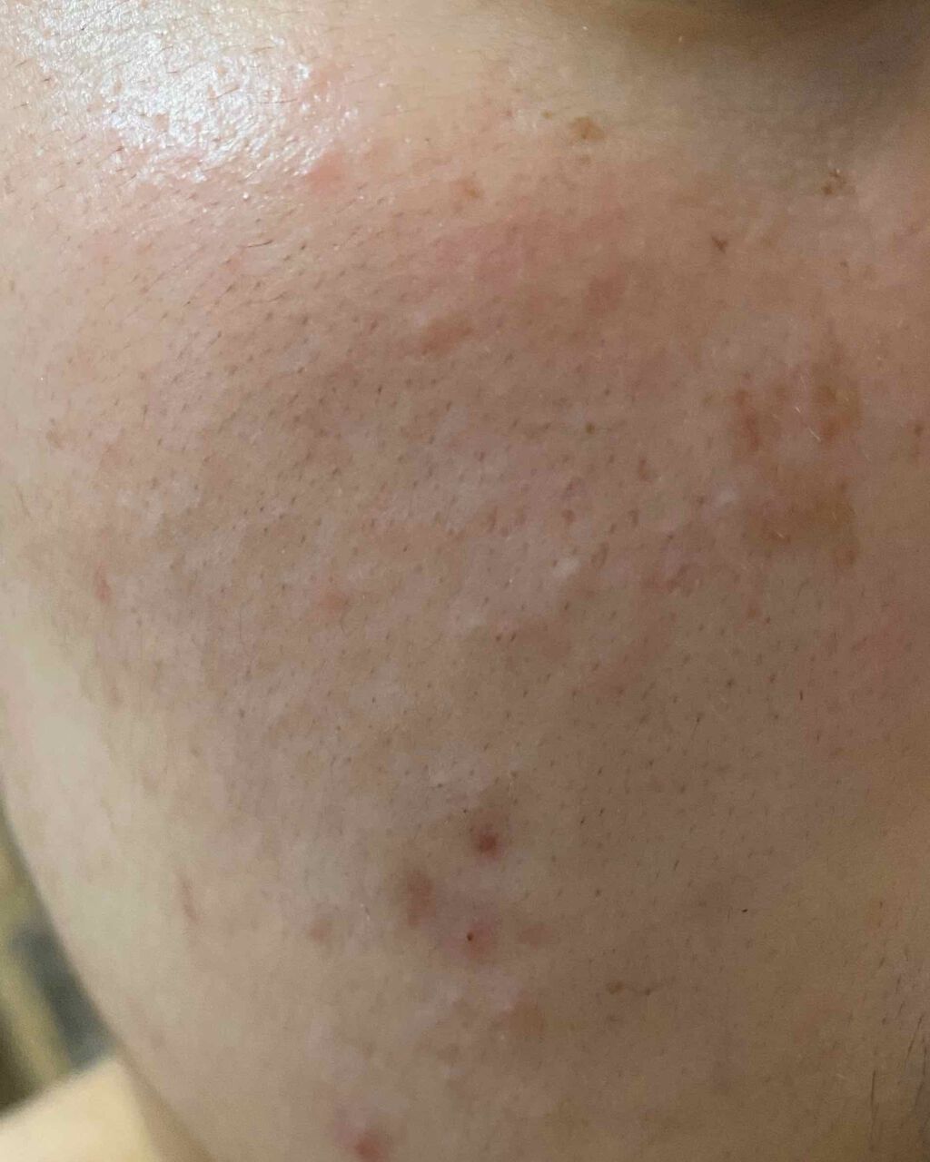 DETクリア ブライト&ピール フルーツ酵素パウダーウォッシュ/Detclear/洗顔パウダーを使ったクチコミ（2枚目）