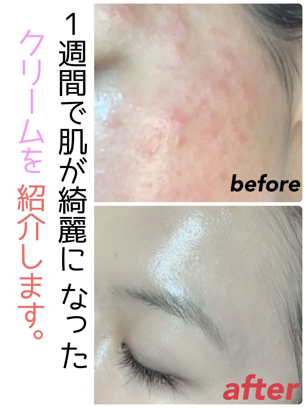 レチノールA 1% アドバンスドリバイタリゼーションクリーム/Life-flo/フェイスクリームを使ったクチコミ（1枚目）