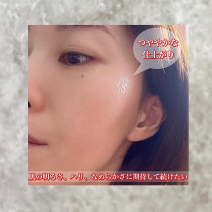 アルティミューン パワライジング コンセントレート Ⅲn/SHISEIDO/美容液を使ったクチコミ(4枚目)